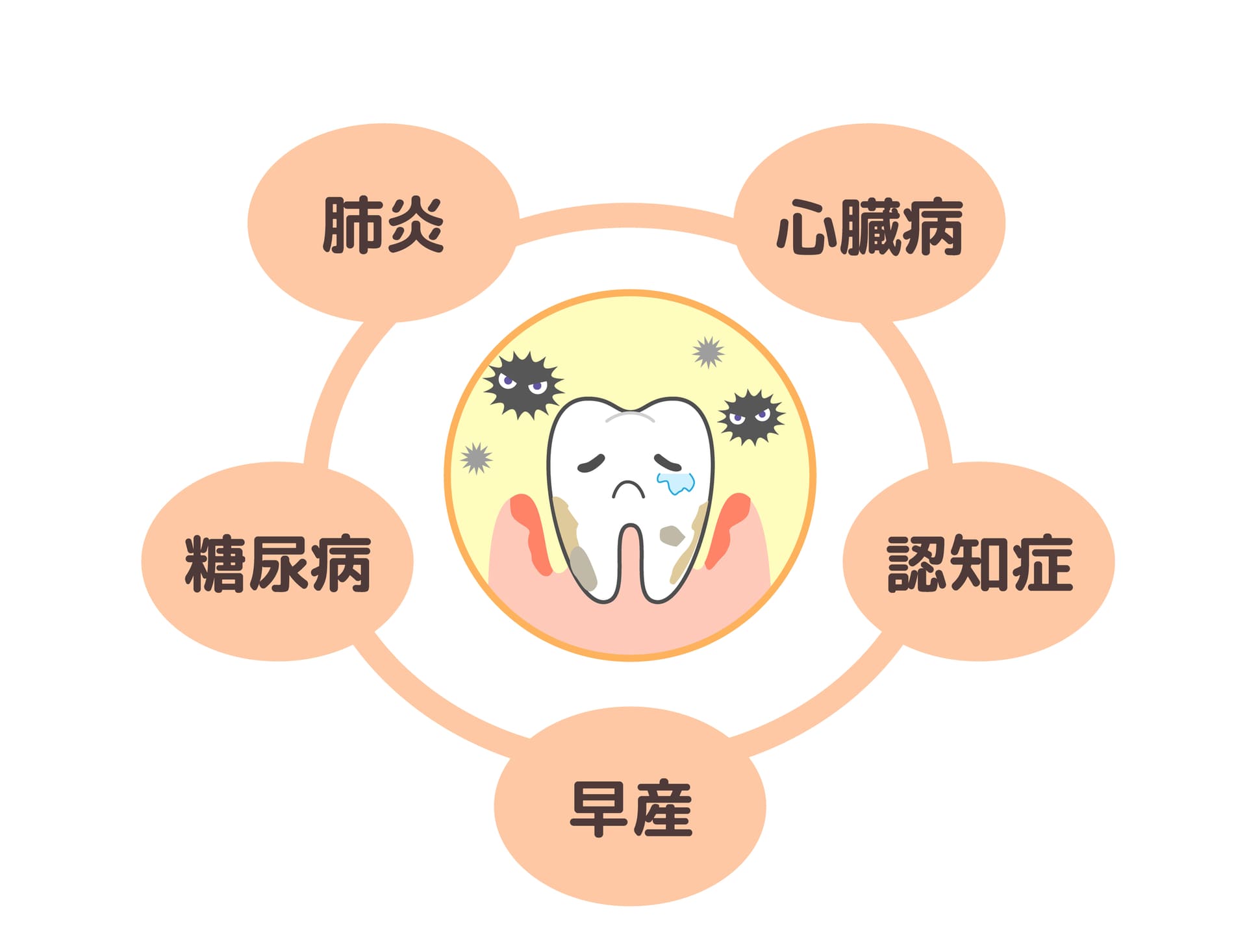 歯周病は様々な全身疾患の原因となっています